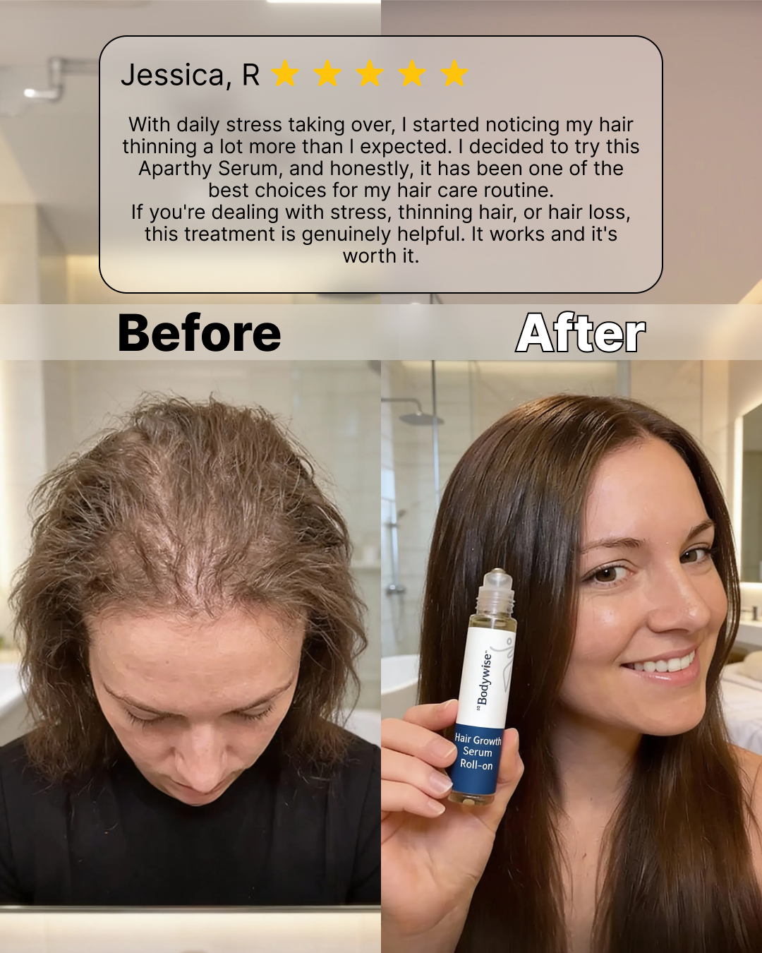 Zoolora Hair Growth Roll-On Serum