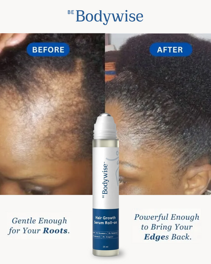 Zoolora Hair Growth Roll-On Serum